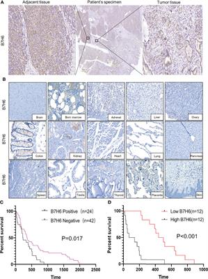 B7H6 Serves as a Negative Prognostic Marker and an Immune Modulator in Human Pancreatic Cancer